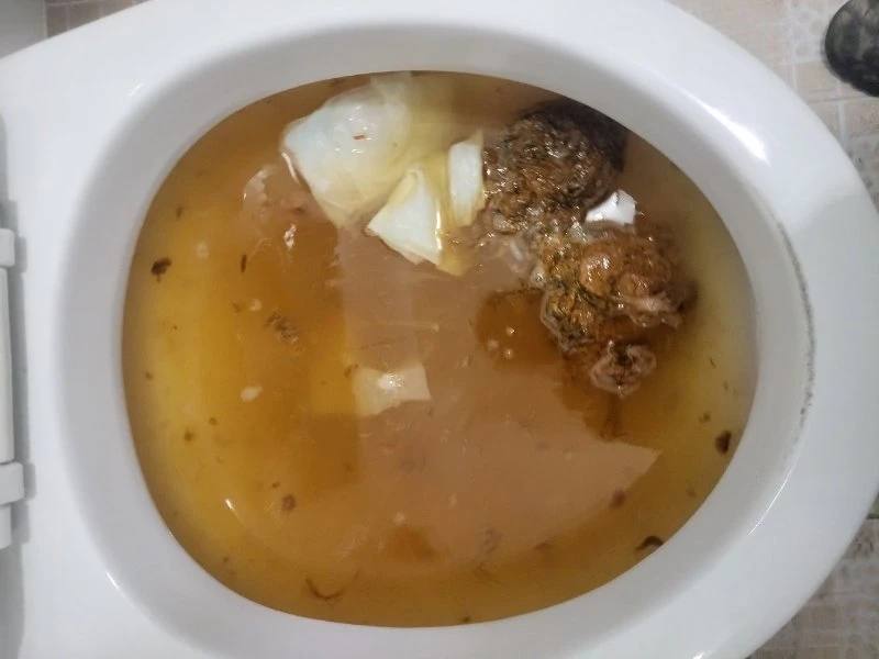 노원구 변기막힘 작업사례 6